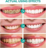 cvrdwear dentifrice mousse blanchiment doux pour un sourire éclatant.