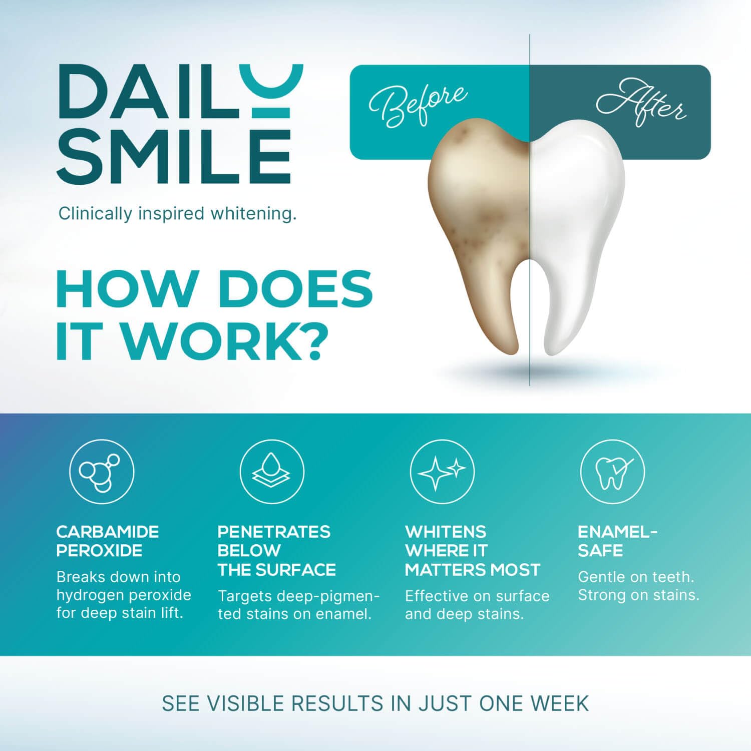 DailySmile gel-blanchiment-sensitive, formule douce adaptée aux sensibilités dentaires.
