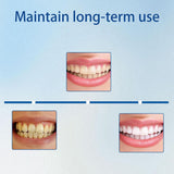 Dentite Armure – utilisation après brossage, pratique et rapide.