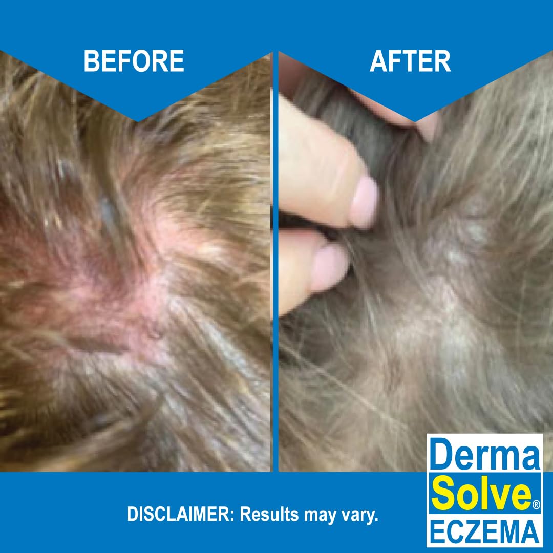 Dermasolve Technologie Ovasome – nutriments essentiels pour peau et cheveux