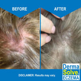 Dermasolve Technologie Ovasome – nutriments essentiels pour peau et cheveux