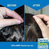Dermasolve utilise la technologie Ovasome à base d oeuf pour nourrir la peau.
