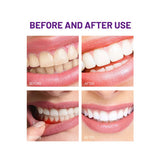 DISAAR Beauty dents sensibles, brossage doux et agréable.