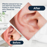 Elephant Ear Washer par Doctor Easy, contrôle efficace de la pression pour un rinçage ciblé.