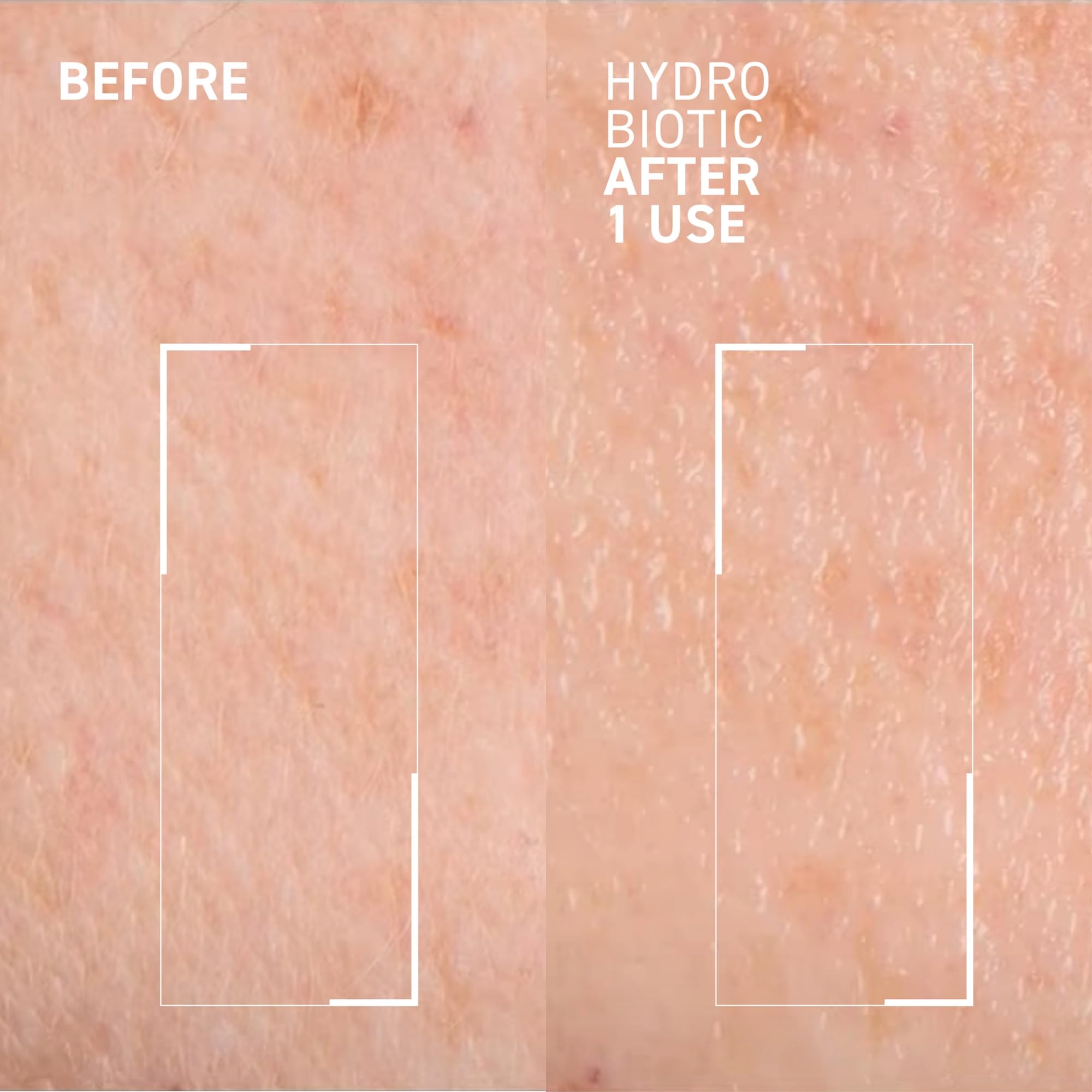 Dr. Brandt Hydro Biotic texture gel-creme : sensation rafraîchissante et hydratante.