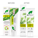Utilisation quotidienne du dentifrice arbre à thé, haleine fraîche.