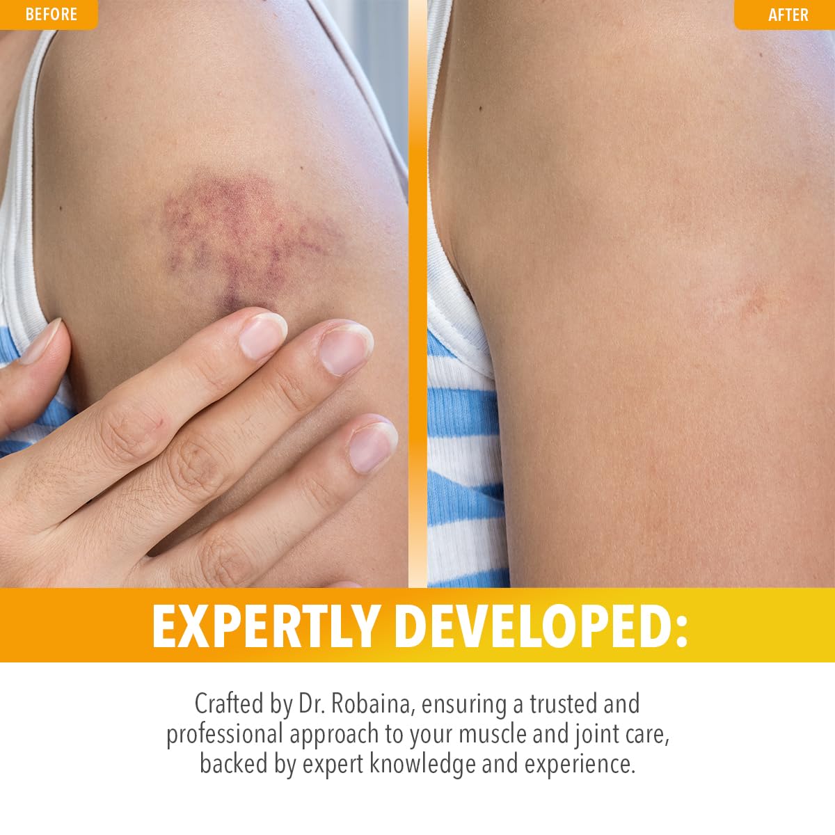 Dr. Robaina Arnica Roll-On, complexe Arnica Montana et Vitamine K pour soin ciblé.