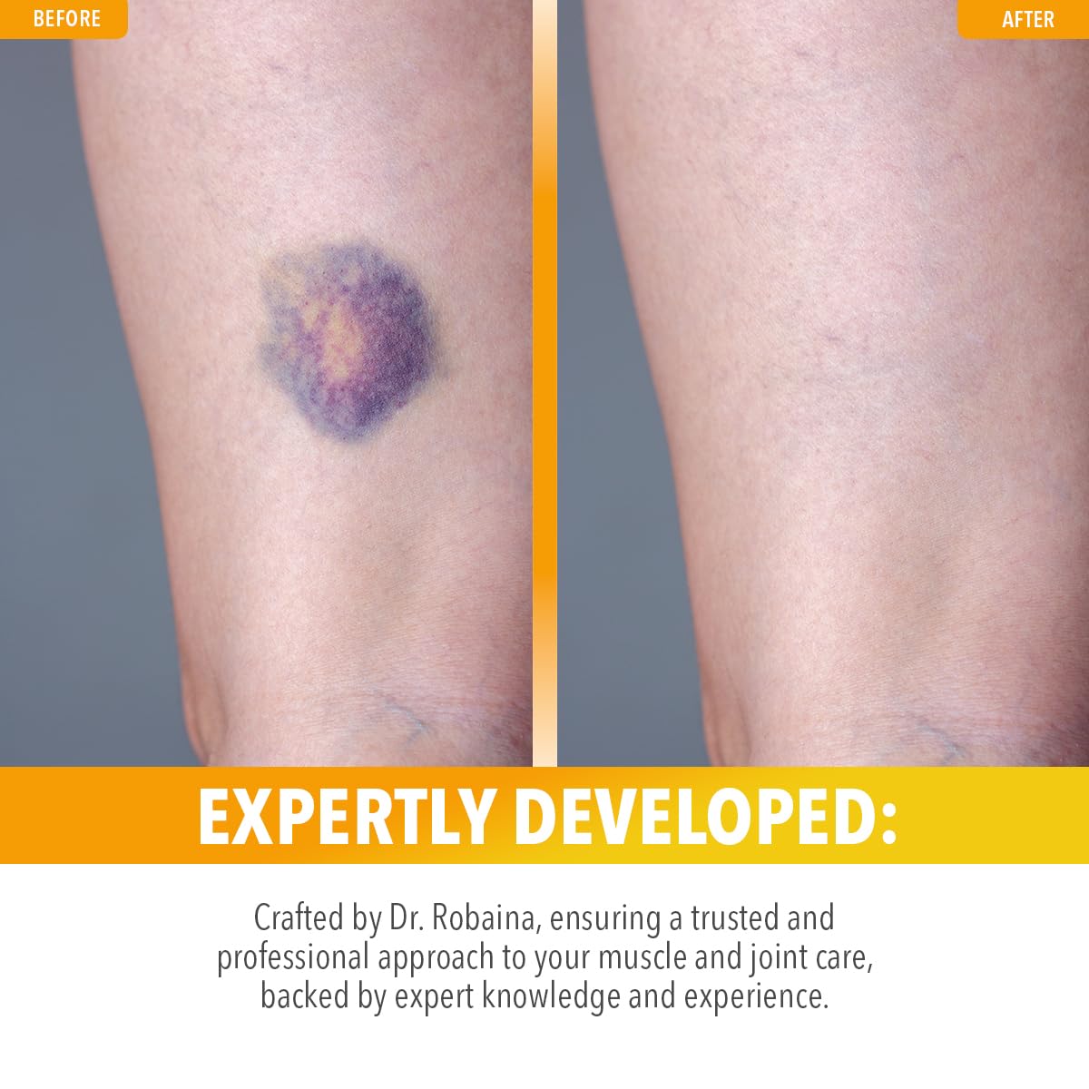 Utilisation quotidienne avec Dr. Robaina Arnica Salve dans le sac de sport.