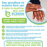 Texture douce des lingettes Eczema Flare Wipes pour calmer les démangeaisons