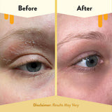 Crème yeux Eczema Honey sans cruauté certifiée Leaping Bunny