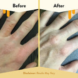 ECZEMA HONEY – ingrédients naturels: avoine colloïdale, miel et aloe vera