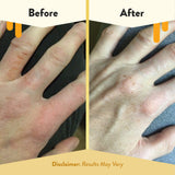ECZEMA HONEY Sans parabènes et parfum — soin peau sensible