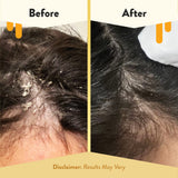ECZEMA HONEY — formule sans parabens et sans sulfates, respectueuse de la peau.