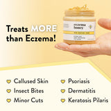 ECZEMA HONEY - ingrédients clés: miel biologique et cire d’abeille pour nourrir la peau.