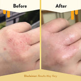 ECZEMA HONEY - texture crème naturelle, douceur et hydratation rapide.