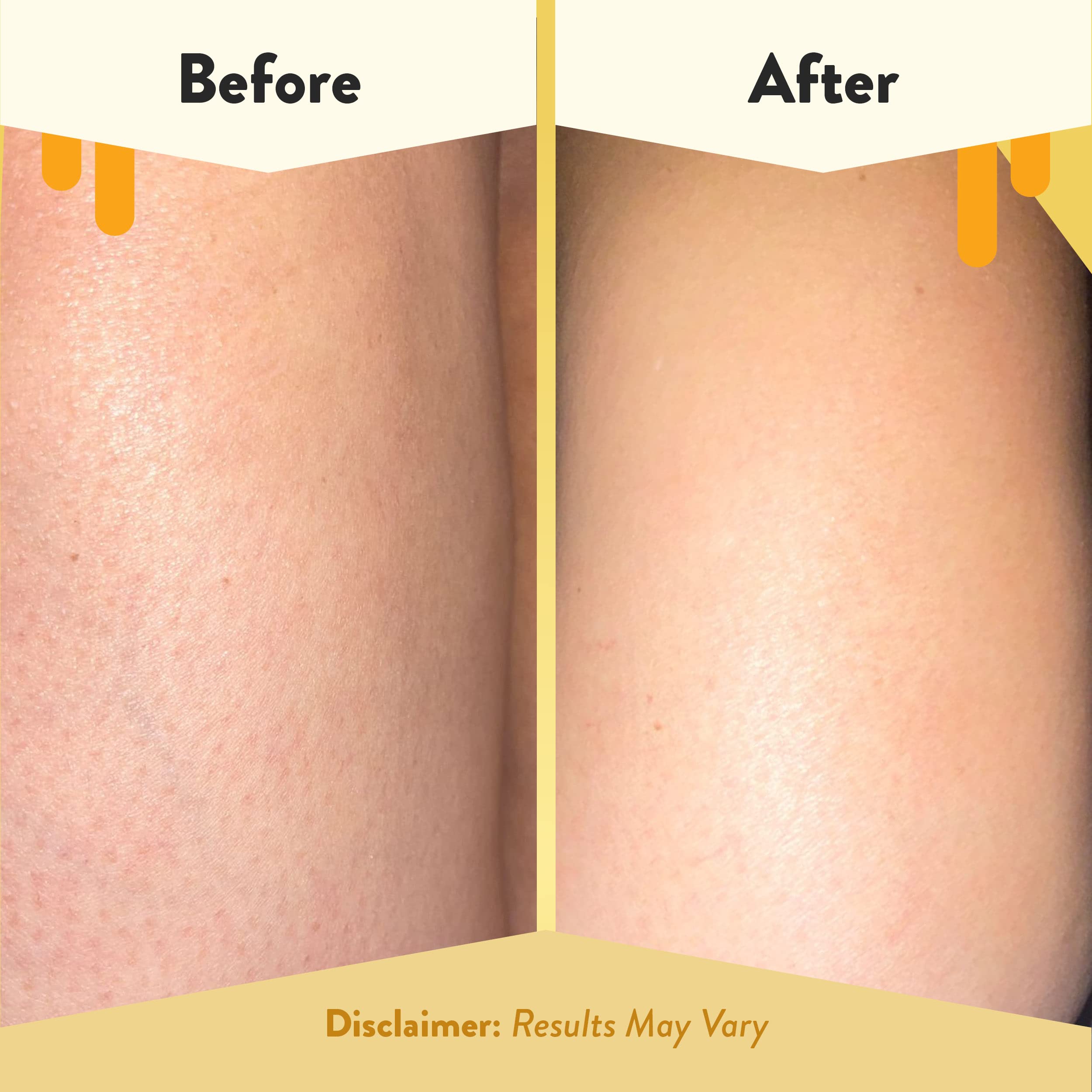 ECZEMA HONEY: Utilisation adaptée pour toute la famille, y compris bébés.