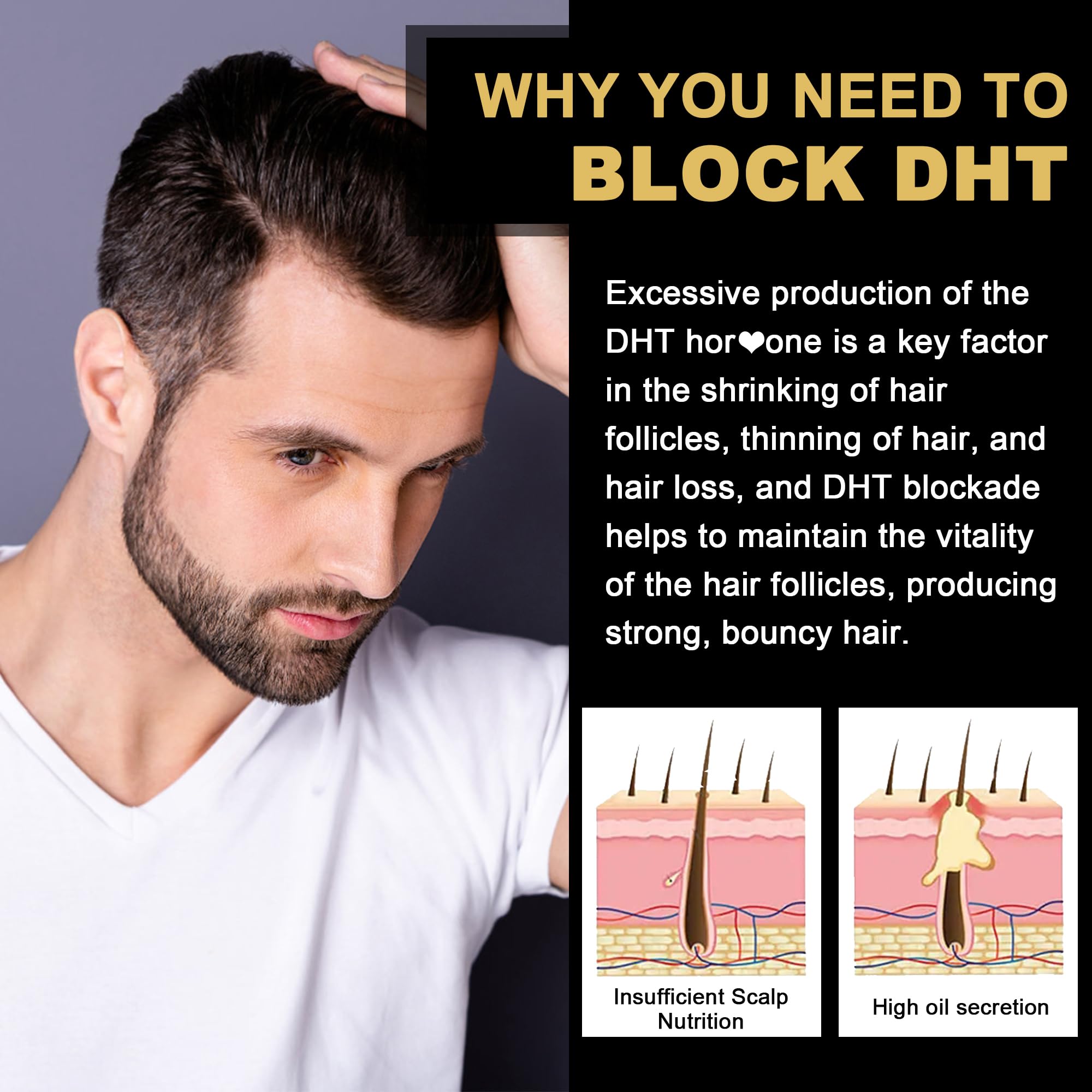 EnvyDeal gommes bloqueuses DHT – gros plan sur les gommes et texture agréable.