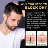EnvyDeal gommes bloqueuses DHT – gros plan sur les gommes et texture agréable.