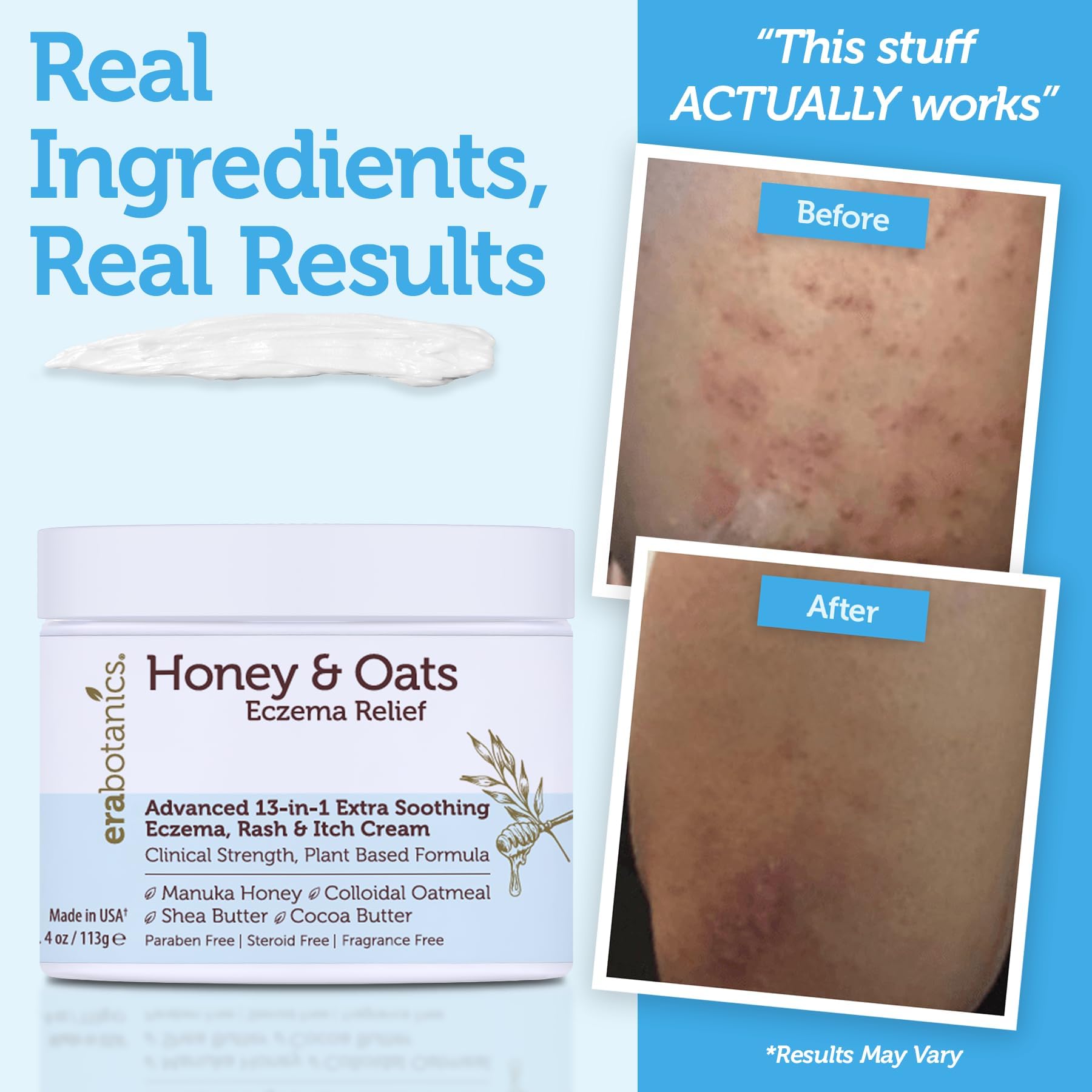 Era Organics crème éczéma apaisement irritations — usage quotidien