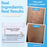 Era Organics crème éczéma apaisement irritations — usage quotidien