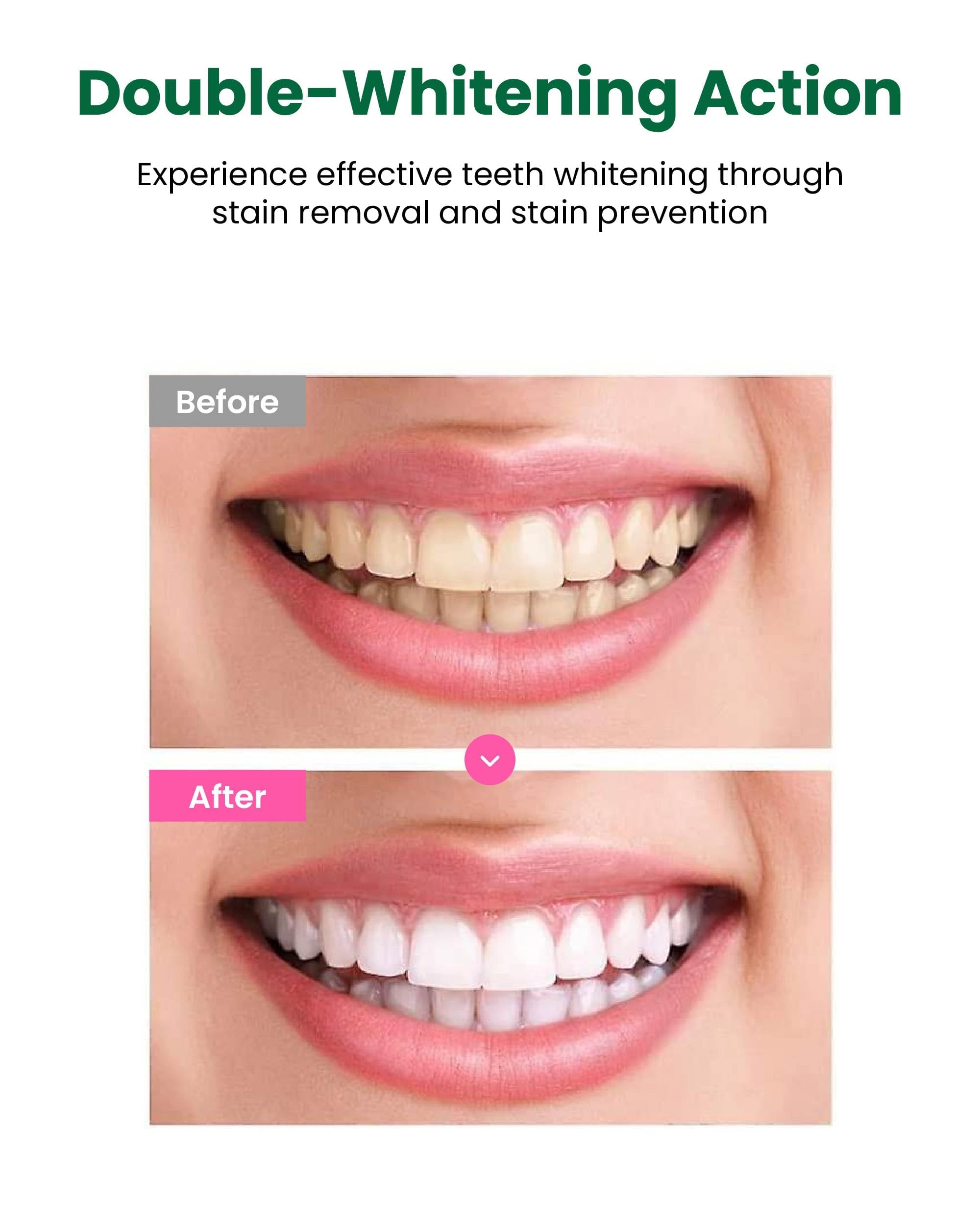 Fluorure 1000 ppm pour une protection anti-caries avec Euthymol.