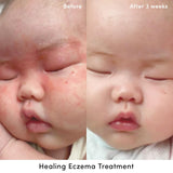 Evereden Crème Eczéma – Texture légère qui pénètre rapidement sans film gras.