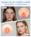 EVFOFO masque LED 7 couleurs – infrarouge pour peau tonifiée et lumineuse