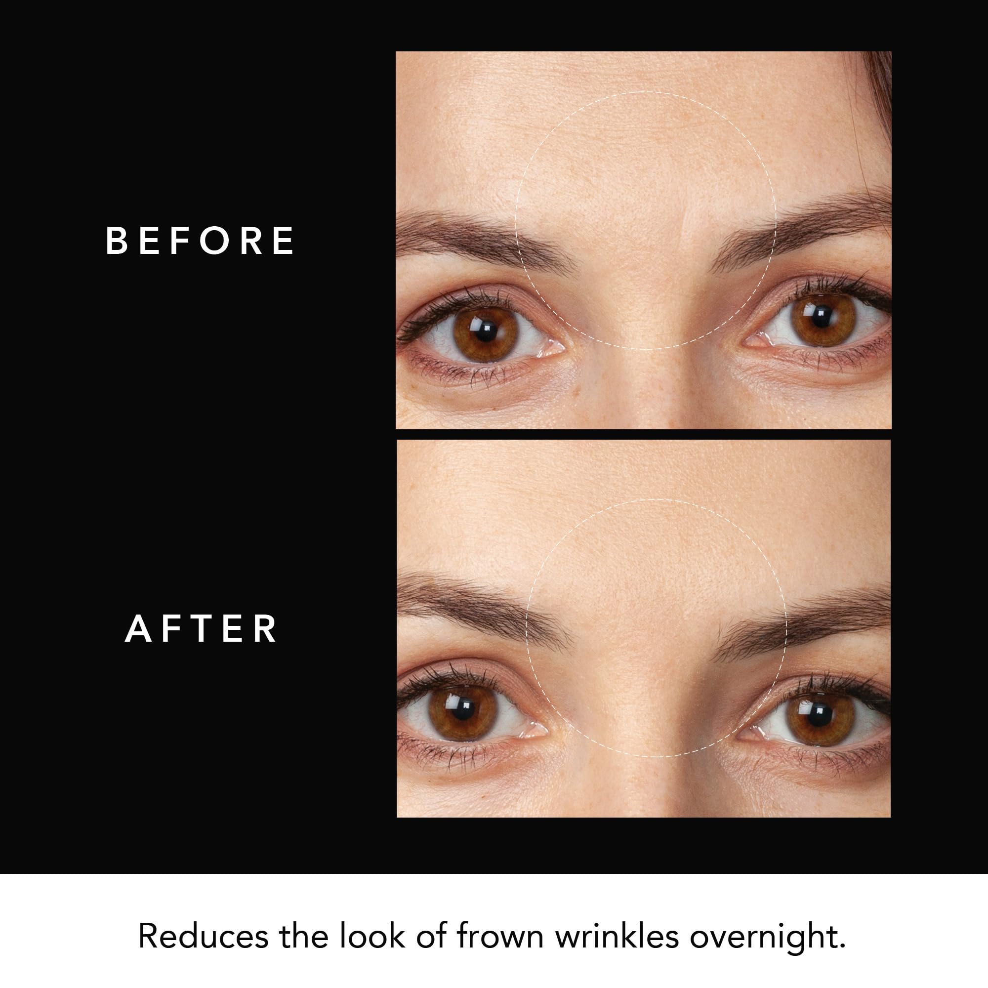 FAQ Patch Hyaluronique Front – confort adhésif et hydratation légère.