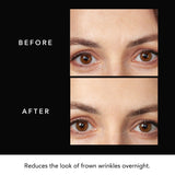 FAQ Patch Hyaluronique Front – confort adhésif et hydratation légère.