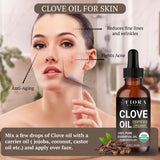 Soin dents et gencives Fiora Naturals huile clou de girofle diluée.