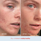 Utilisation visage et corps pour hydratation quotidienne avec Ultra Repair Cream.