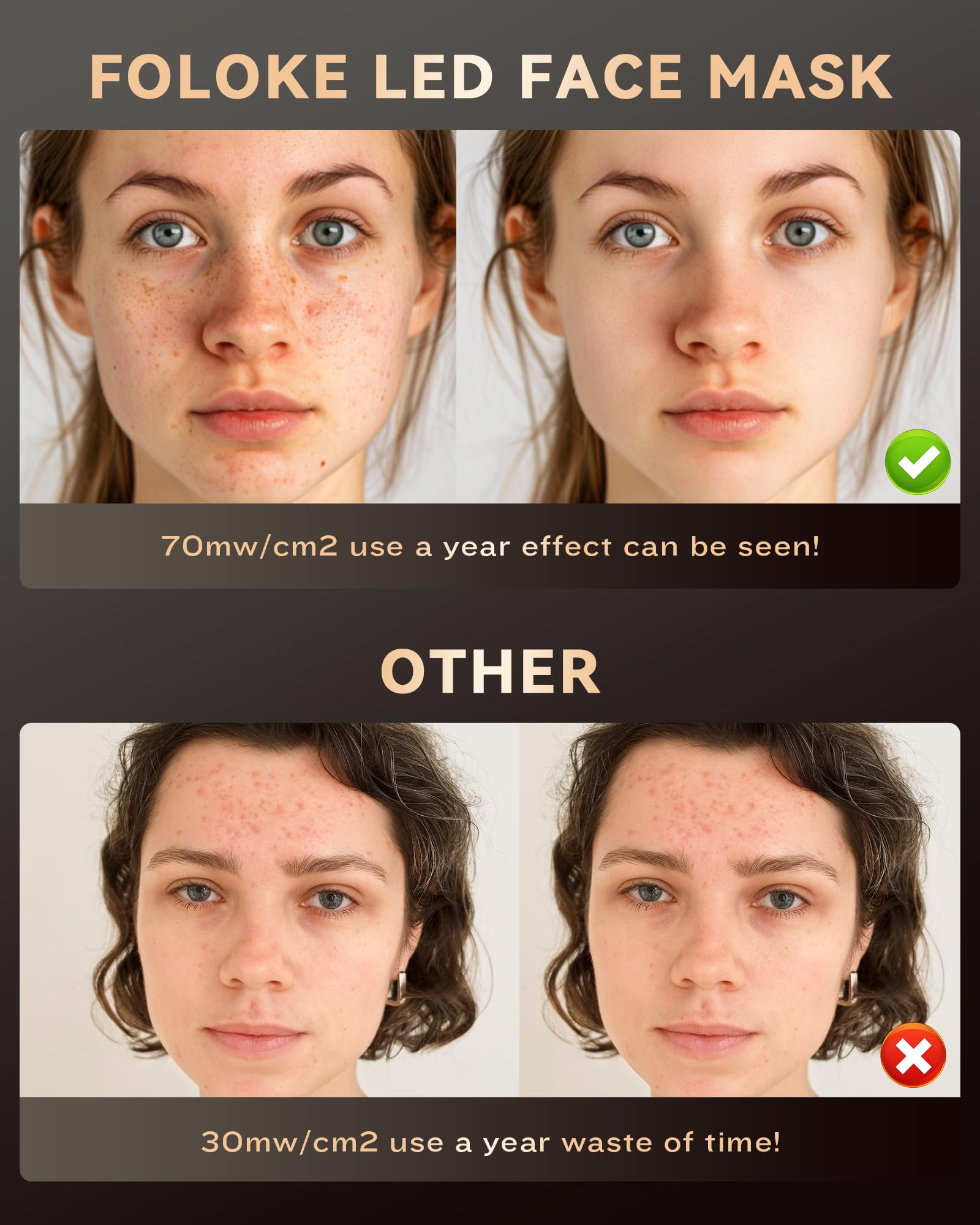 FOLOKE silicone doux et hypoallergénique, confort du masque