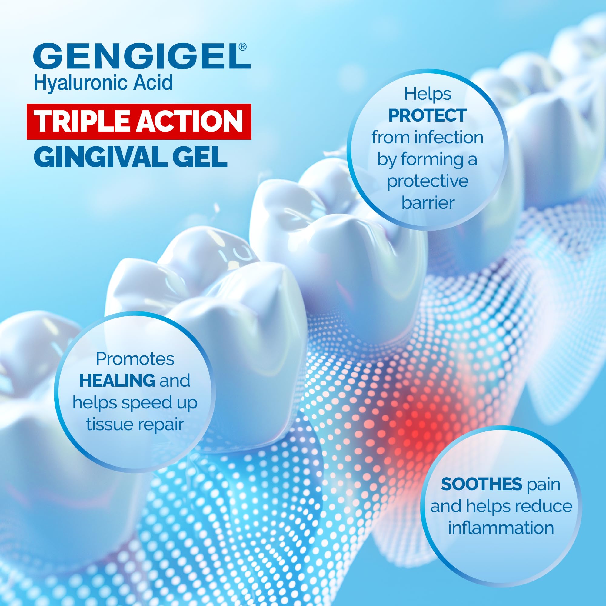 Gengigel : gel buccal pour soulager rapidement la douleur buccale.