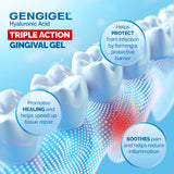 Gengigel : gel buccal pour soulager rapidement la douleur buccale.