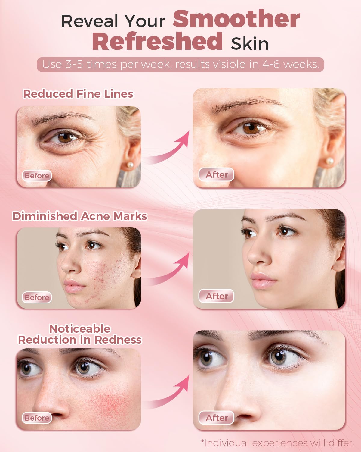 Glamesty Masque silicone doux pour le visage – douceur et port confortable.