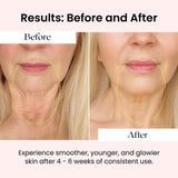 Capsules Glov Beauty NAD+ vues en gros plan sur la texture