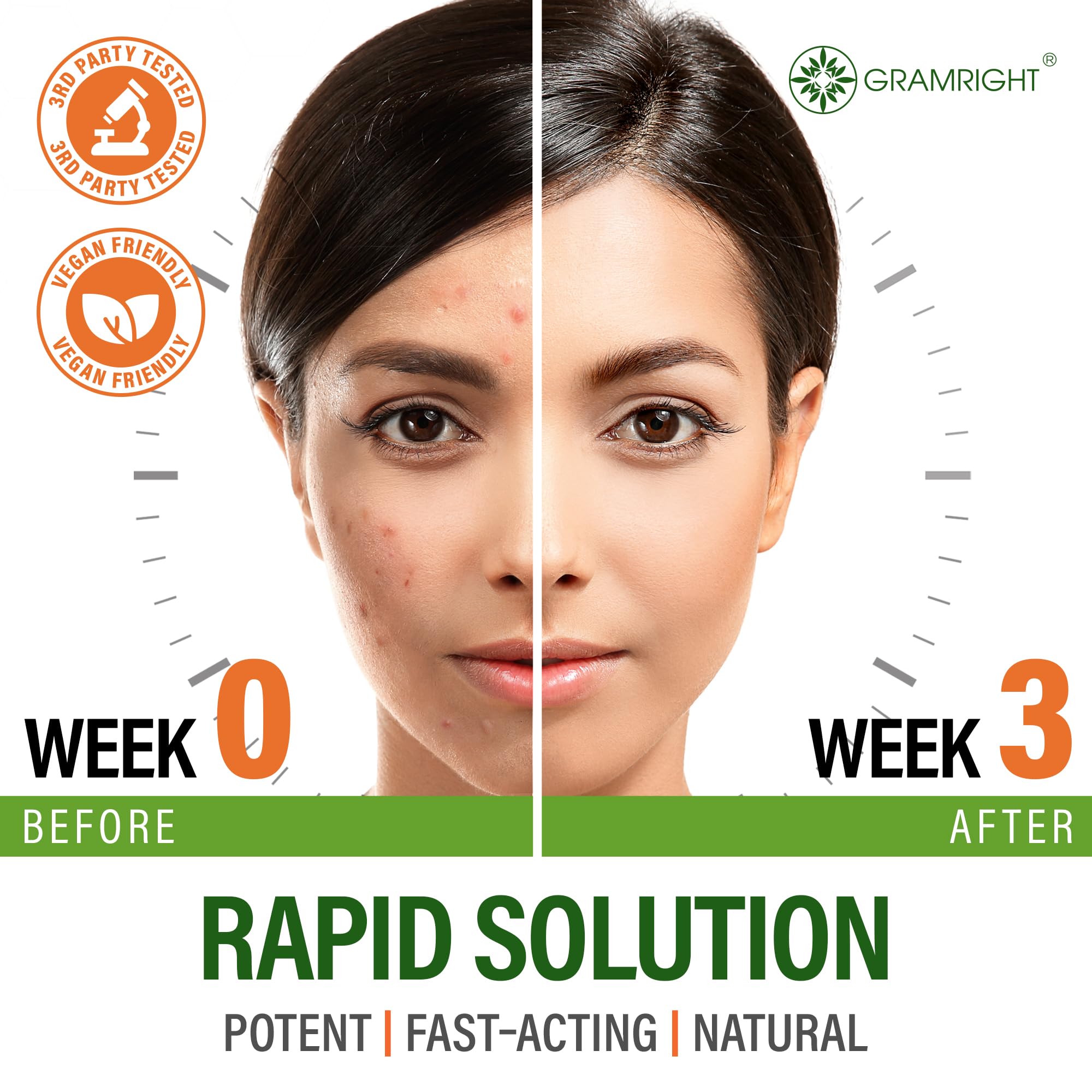 GRAMRIGHT Perfect Skin – capsules visibles, solution anti-acné potentielle