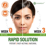 GRAMRIGHT Perfect Skin – capsules visibles, solution anti-acné potentielle