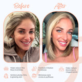Groomie GlowUp infrarouge pour un teint visiblement plus lumineux.