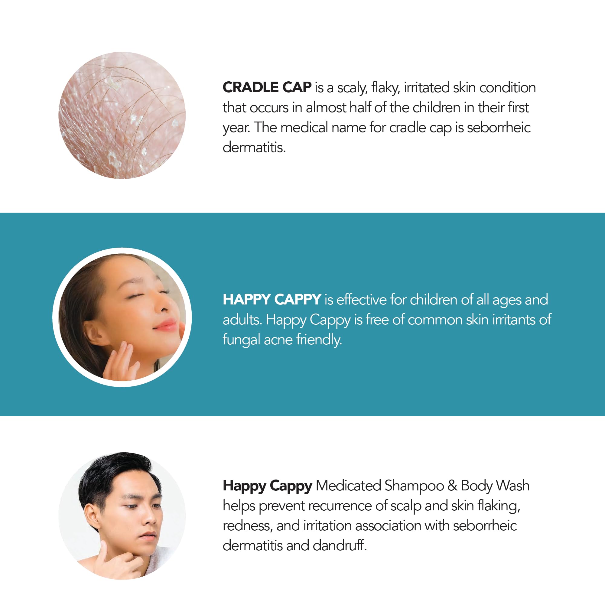 Shampoing Happy Cappy – adapté à tous les âges pour pellicules et rougeurs.