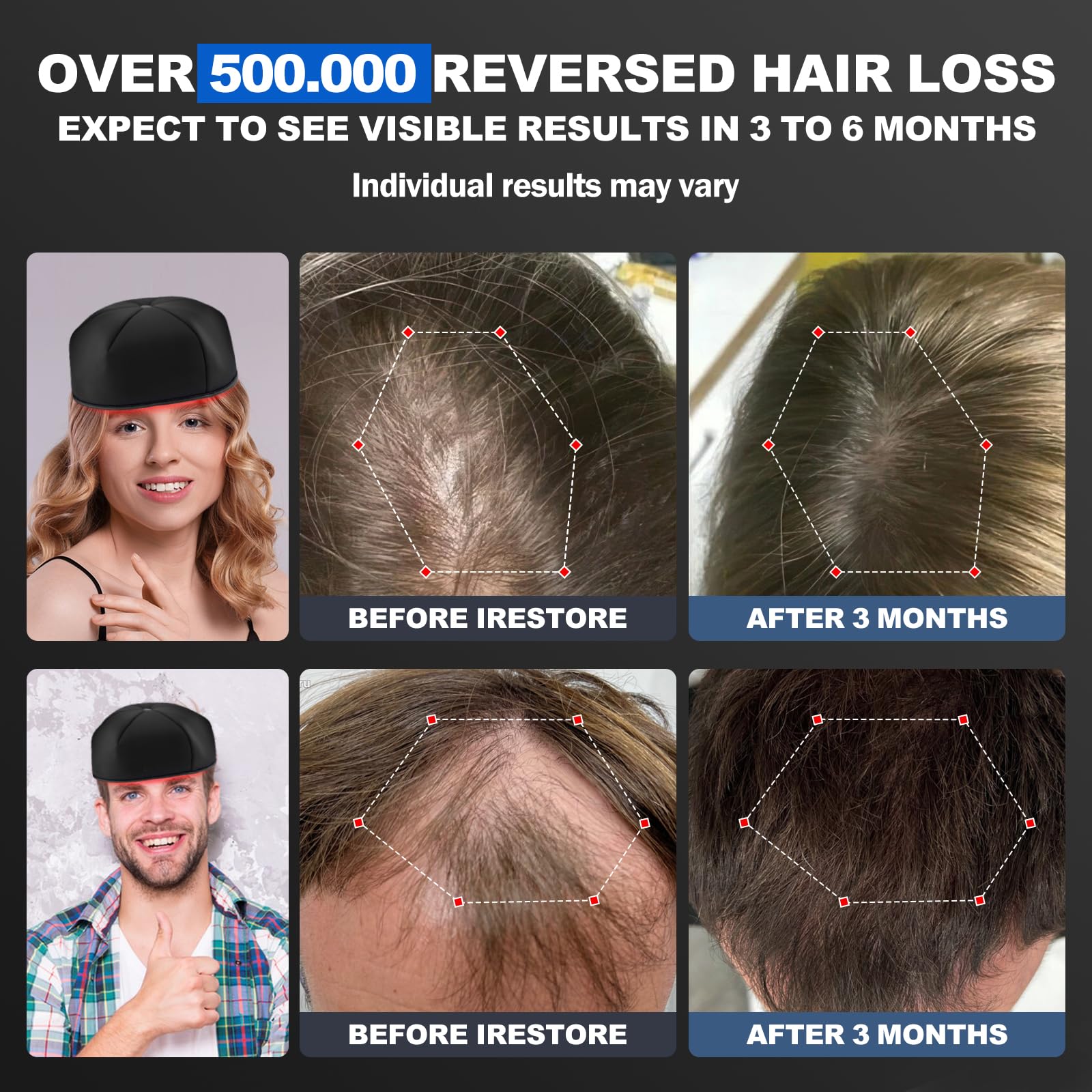 HAUBAT Laser Cap offre confort et rembourrage pour des séances prolongées.