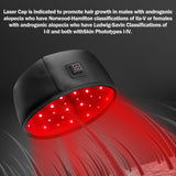 HAUBAT Laser Cap cible la ligne frontale et les tempes.