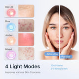 Hello Face: design alvéolaire pour sécurité et confort pendant le soin