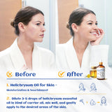 HIQILI Hélichryse diffuseur aromathérapie pour une ambiance apaisante.