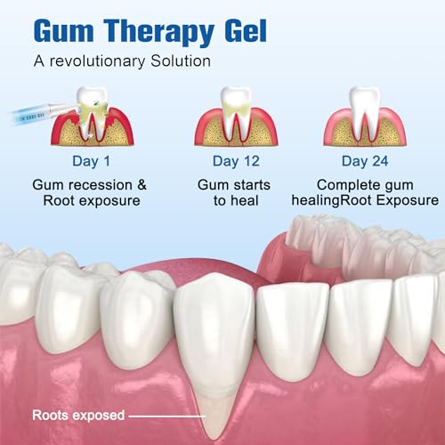 iaredon Taileden GumShield TherapieGel soin des gencives et apaisement des irritations.