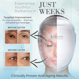 iDerma masque-led diodes haute-radiance, diffusion homogène sur le visage