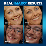 Retrait facile des Imako Premium Uppers après utilisation.