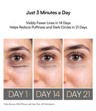 INIA lumière rouge – stimulation douce du contour des yeux.