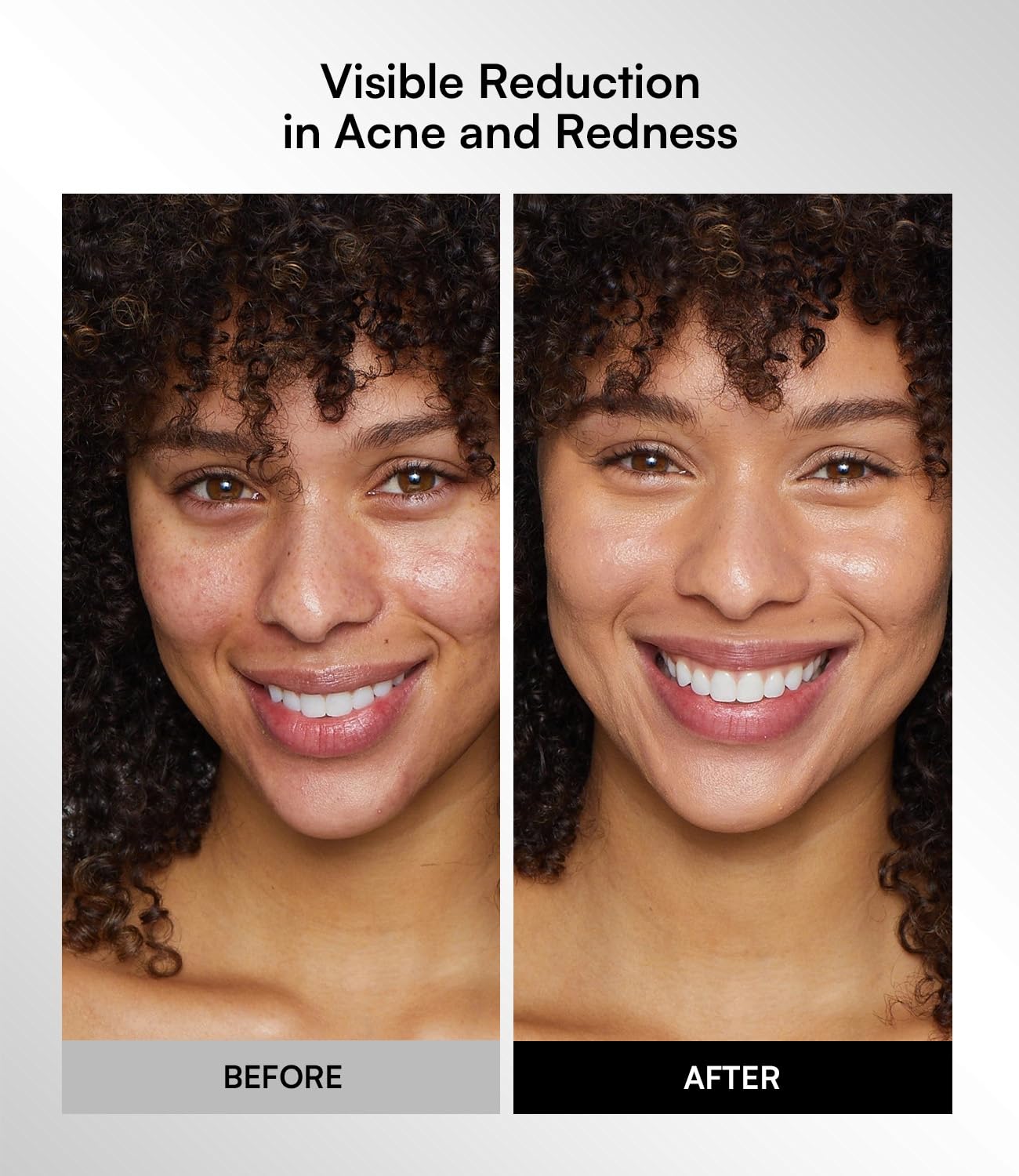 Masque INIA en silicone certifié pour une peau en douceur.