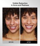 Masque INIA en silicone certifié pour une peau en douceur.